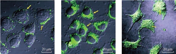 D:\xwu\Nano Biomedicine and Engineering\Articles for production\排版\8(3).p141- NBE-2016-0014 biazar esmaei\stt2.jpg