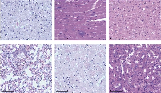 D:\xwu\Nano Biomedicine and Engineering\Articles for production\排版\8(4)\Fei Pan NBE-2016-0040\figs\sct13.jpg