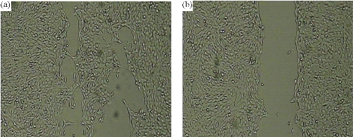 D:\xwu\Nano Biomedicine and Engineering\Articles for production\排版\8(4)\NBE-2016-0025.R1 Faramarzi, Mohammad Ali\fig\mhyt9.jpg