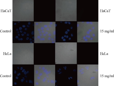 D:\xwu\Nano Biomedicine and Engineering\Articles for production\排版\9(1)\N\figs\vnt5.jpg