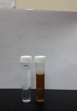 D:\xwu\Nano Biomedicine and Engineering\Articles for production\排版\9(3)\0030 completed\figs\mmrt1.jpg