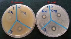 D:\xwu\Nano Biomedicine and Engineering\Articles for production\排版\10(1)\25-33 (Maryam Rad)) (2017-0065)\fig\mr8.jpg